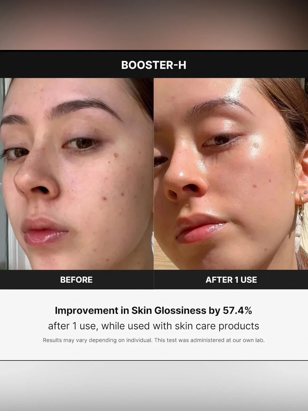 MediCube AGE-R Booster H - Korean Skincare Tool
